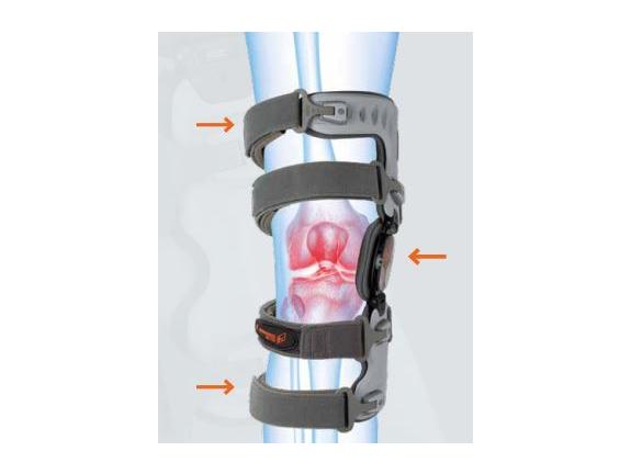 Ortho-A knee brace for OA mode of action