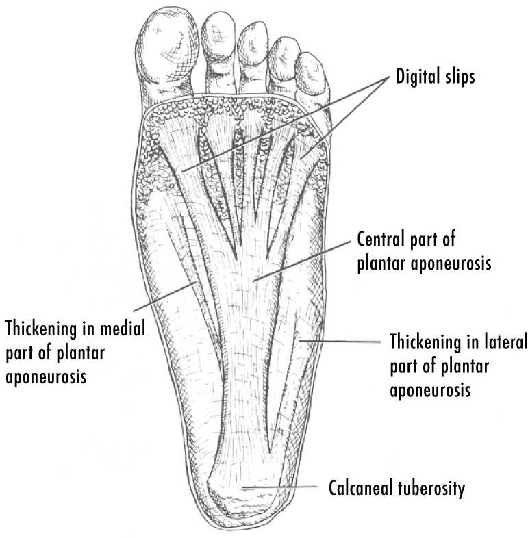 Plantar Fasciitis | Heel That Foot Pain